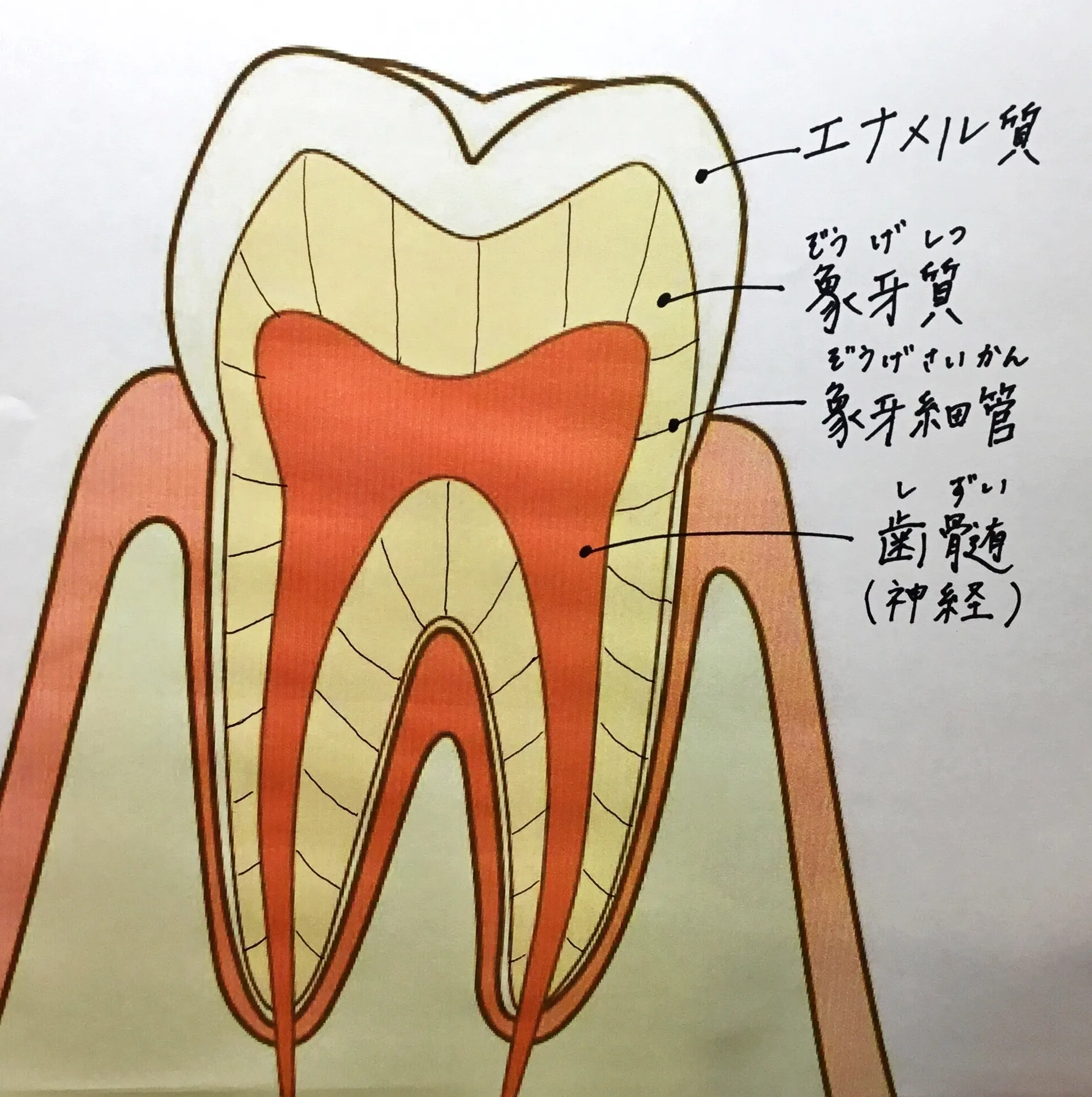 知覚過敏って？