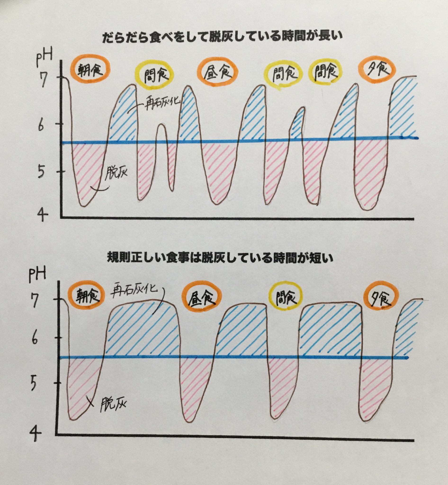 虫歯の原因について
