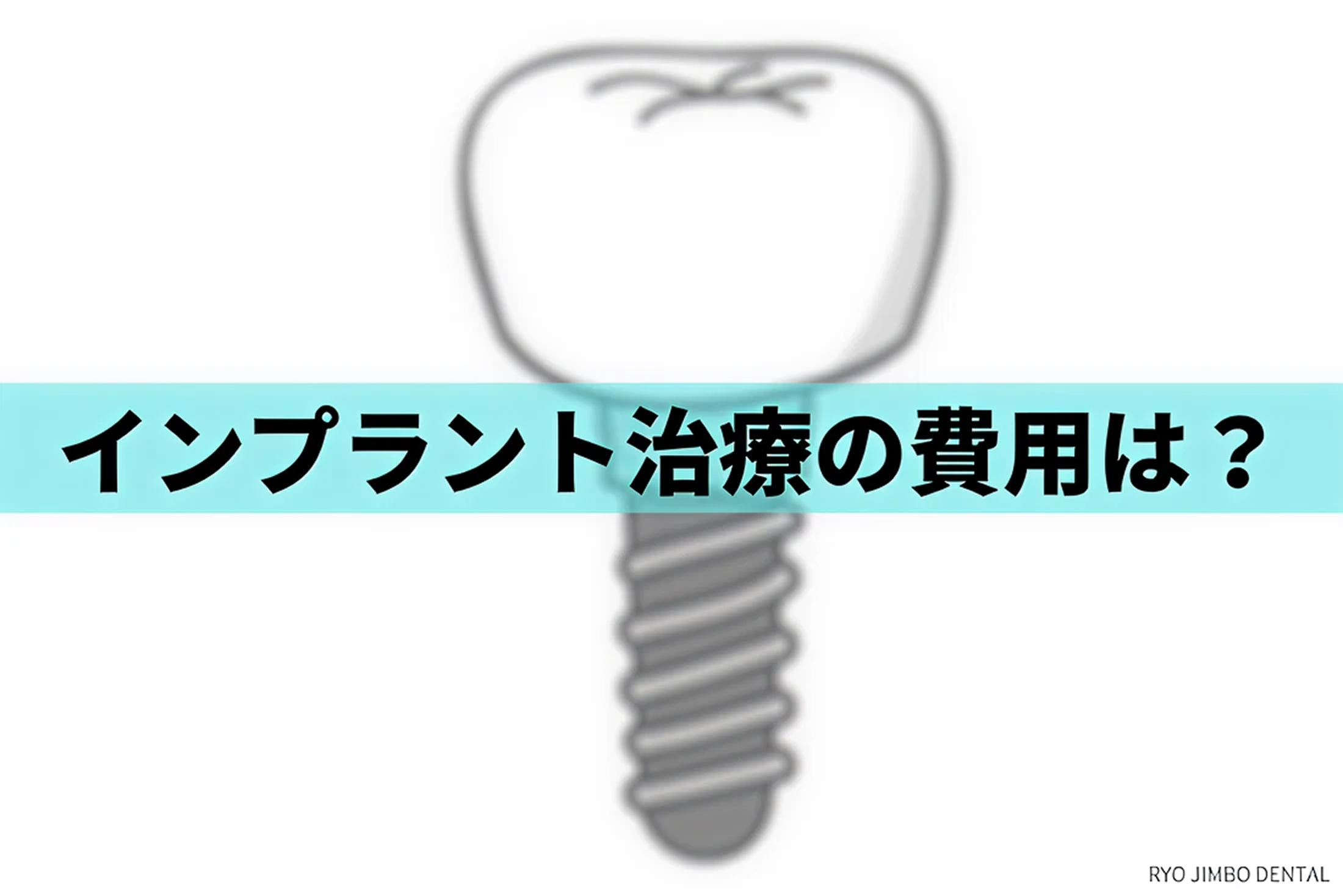 インプラントの費用・治療にかかる料金や相場について解説
