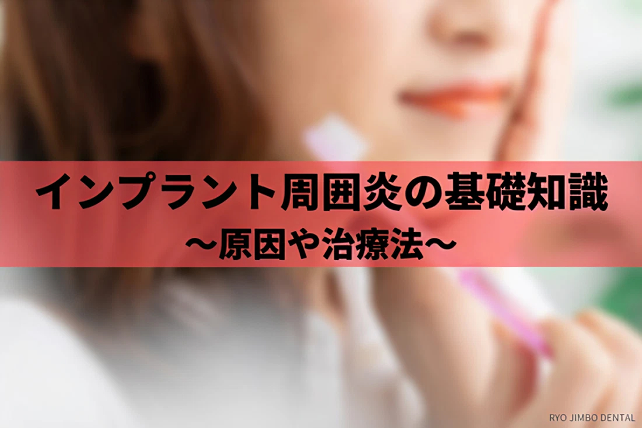 様子見はNG！インプラント周囲炎の原因と治療の基礎知識