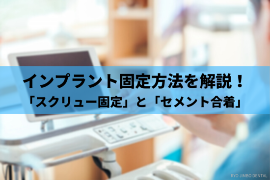 「スクリュー固定」と「セメント合着」2つのインプラント固定方法について