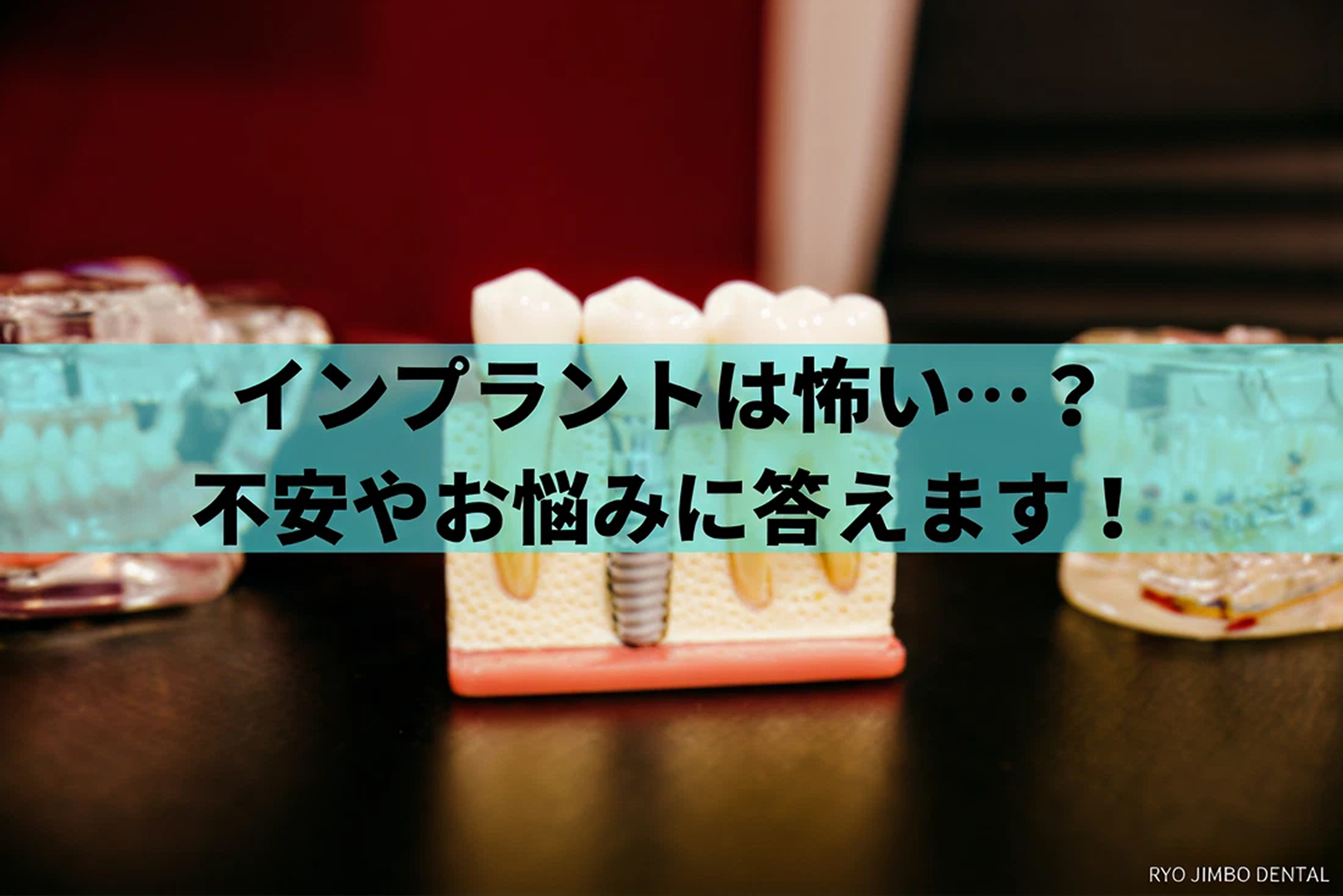 インプラントは怖い？歯科医師が不安やお悩みに答えます