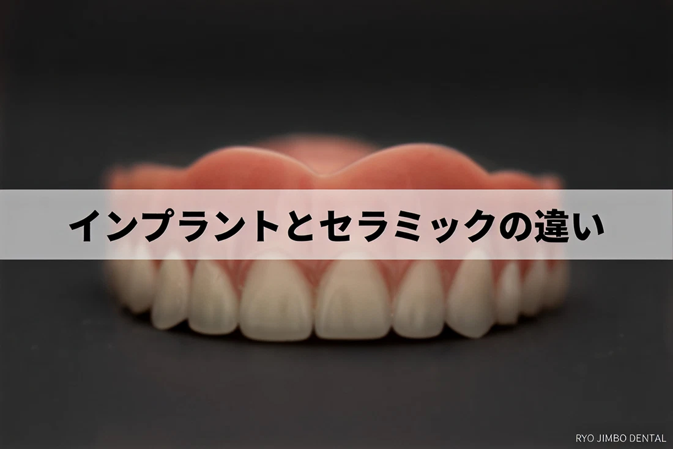 インプラントとセラミックの違いを分かりやすく解説