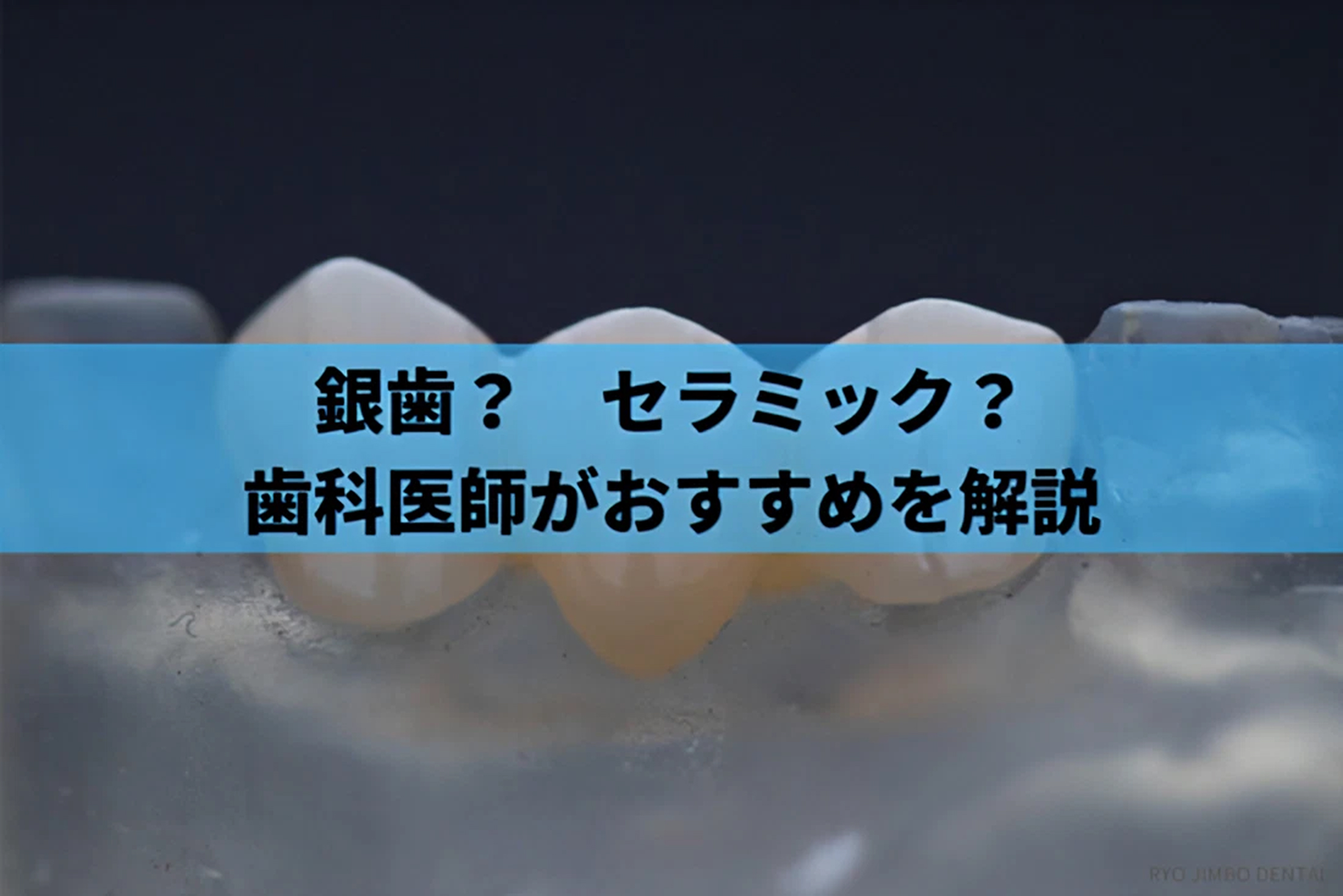 銀歯とセラミックどちらがおすすめかを歯科医師が解説