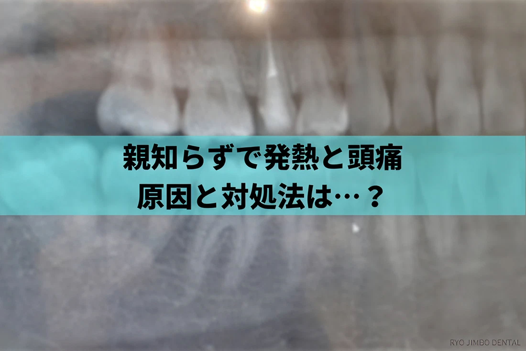 親知らずと発熱について解説！抜歯後の頭痛や熱の原因とは