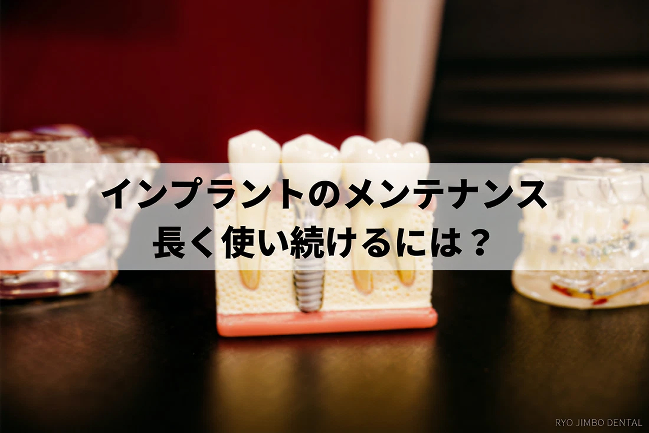 歯科インプラントのメンテナンス方法について｜寿命を延ばす方法を解説