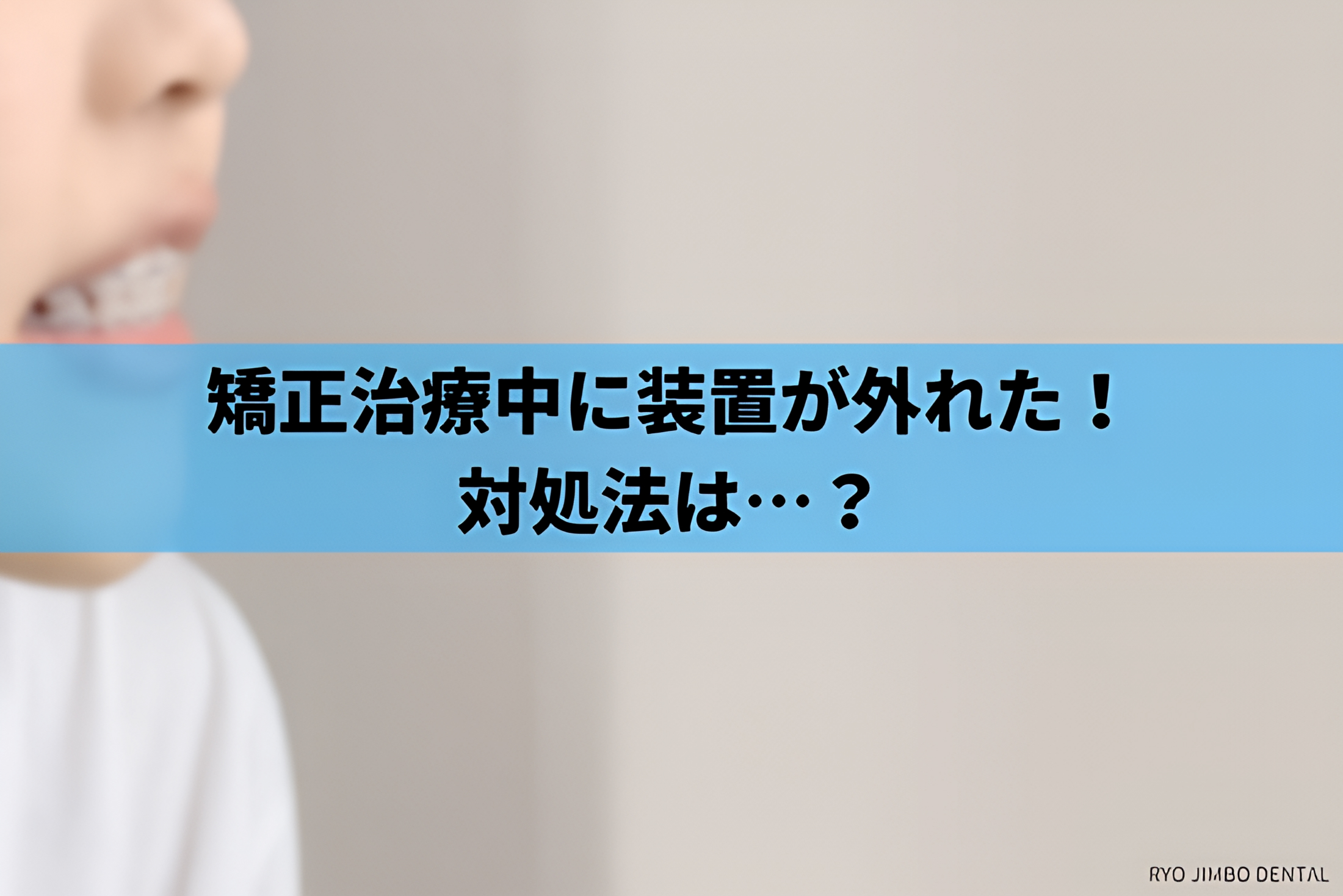 矯正治療中に装置が外れた場合の対処法｜原因や外れやすい人の特徴まで解説