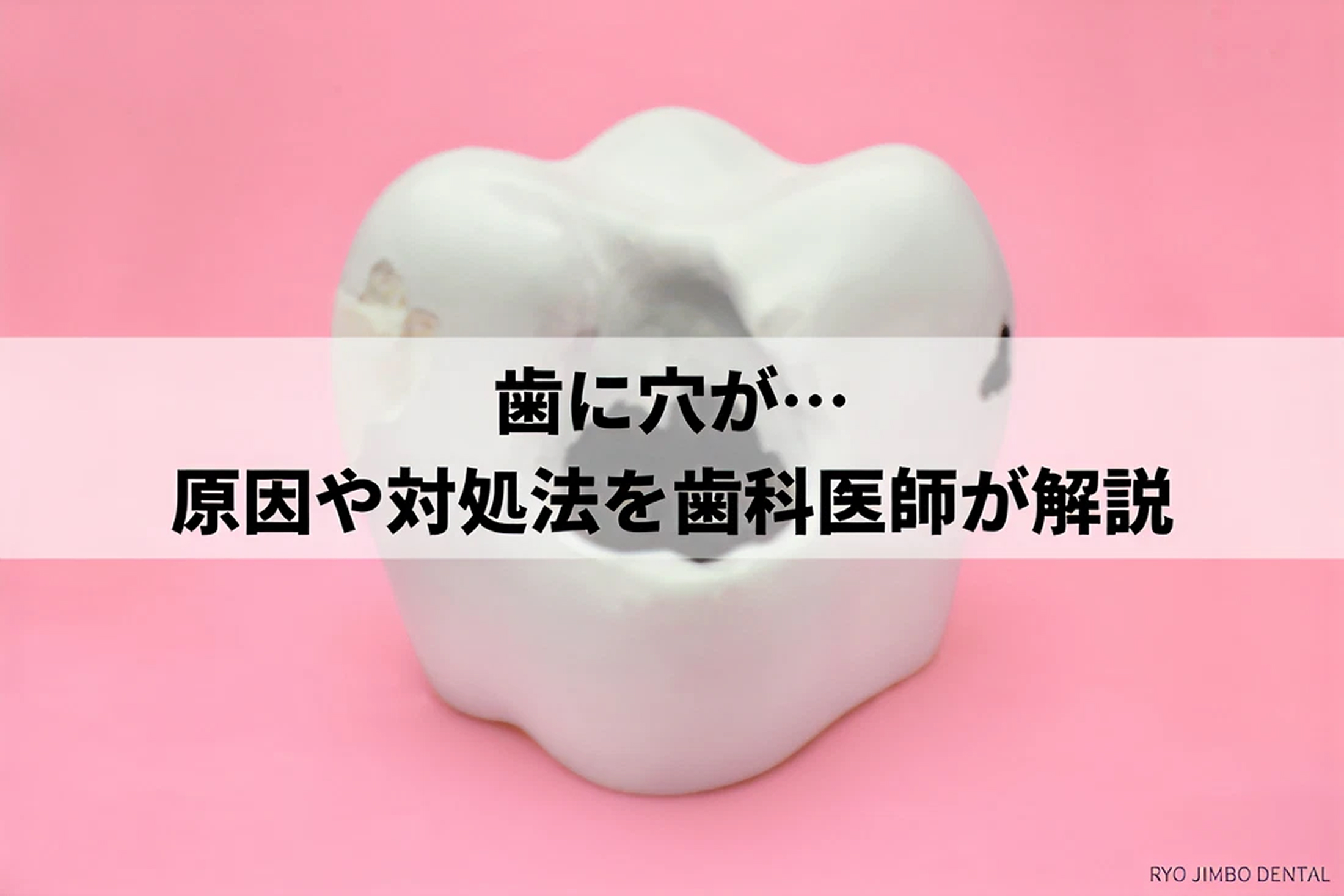 歯に穴が開いてしまった場合の原因や対処・治療法を歯科医院が解説