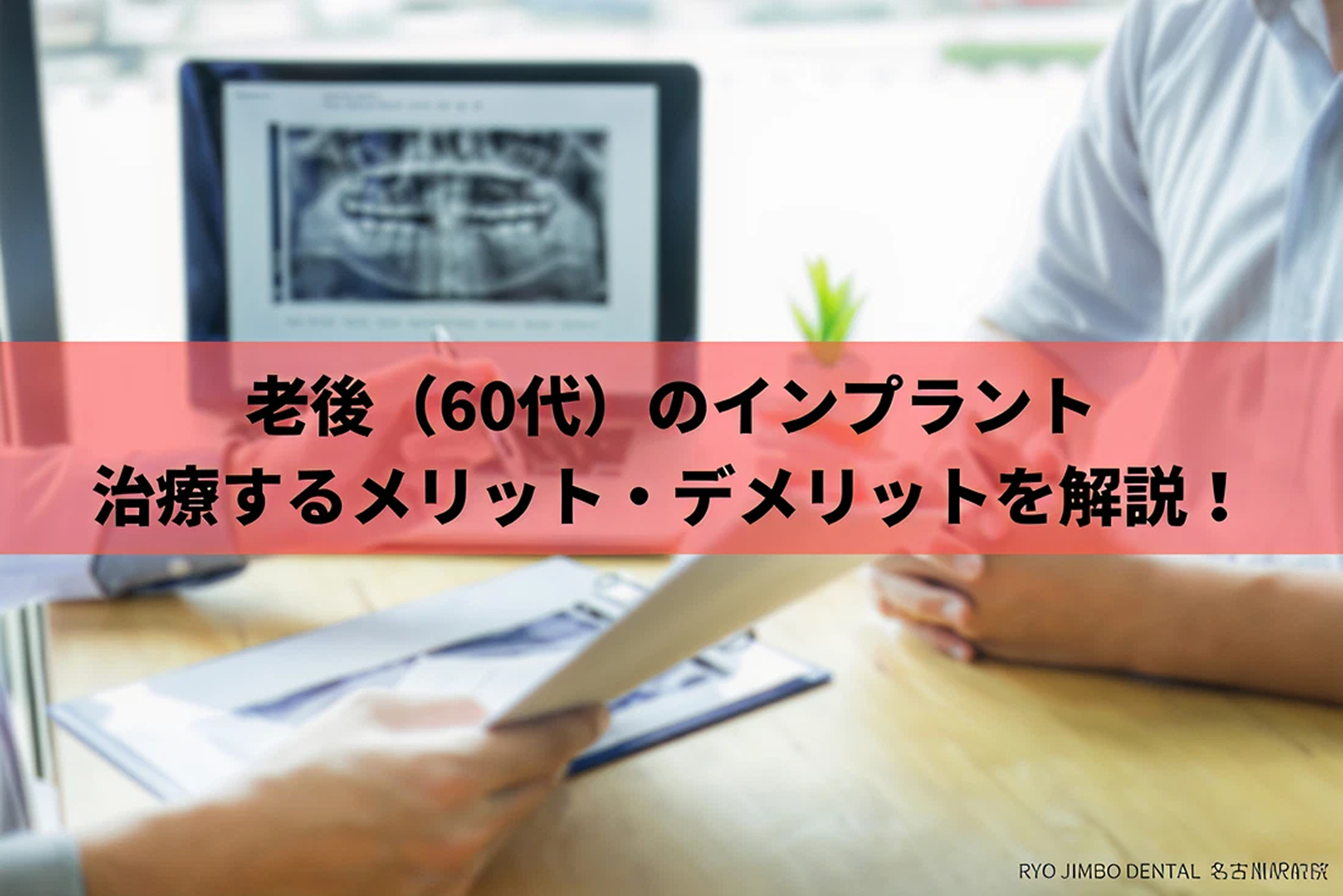 老後を考えたインプラント｜ 60 代での治療やメリット・デメリットを解説