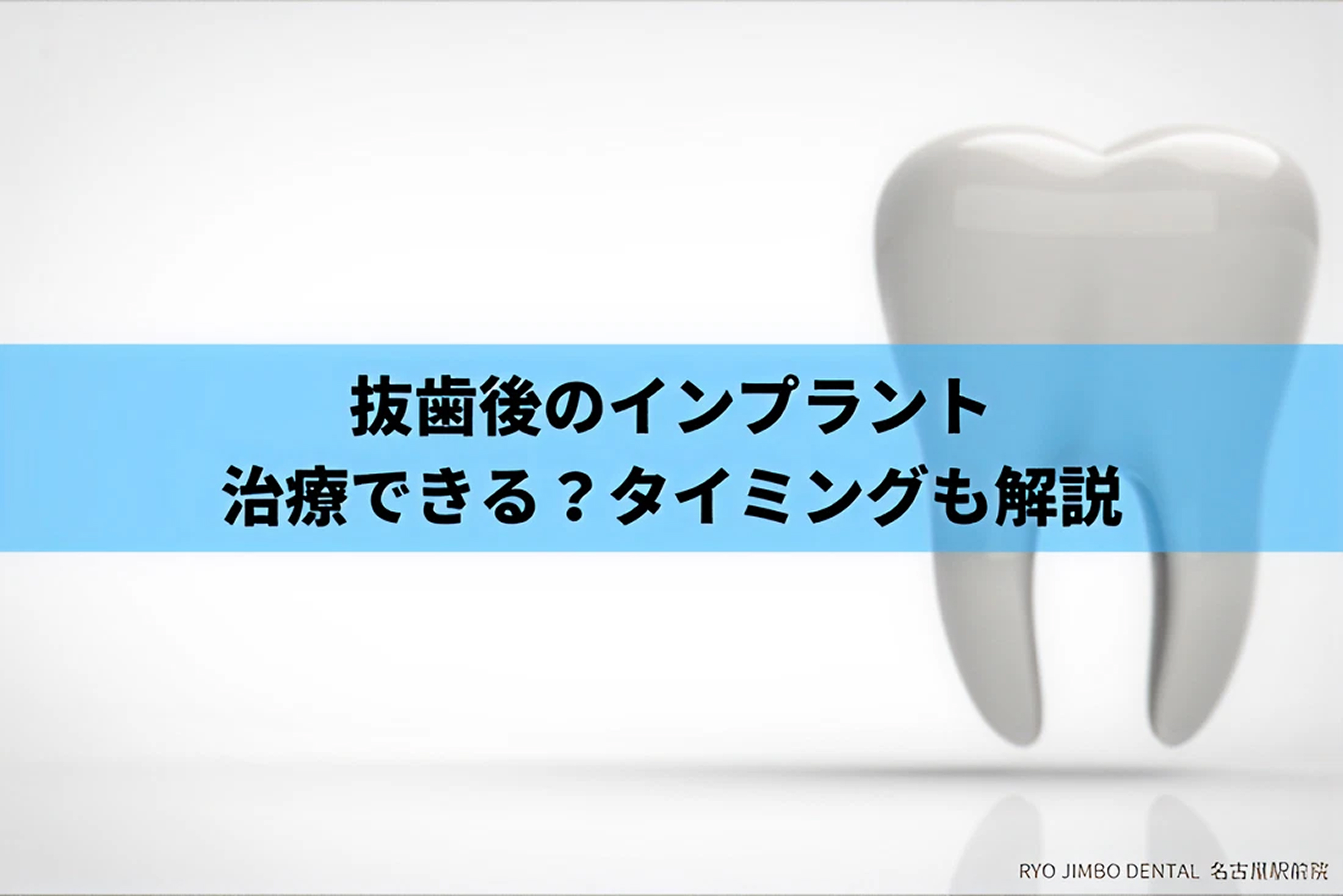 抜歯後のインプラント｜治療可能かや最適なタイミングについて解説
