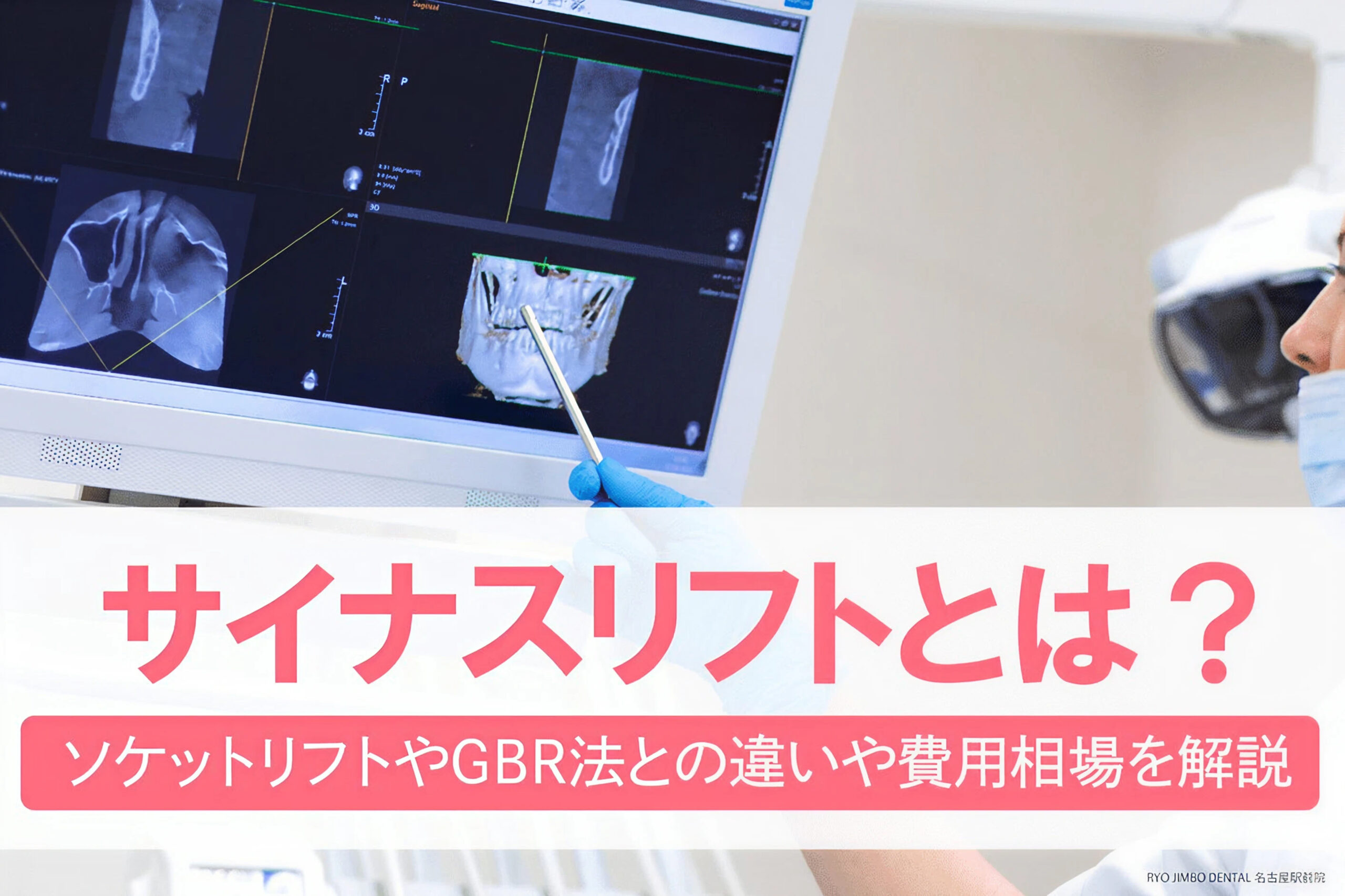 サイナスリフトによる治療の流れとほかの骨再生法との違い
