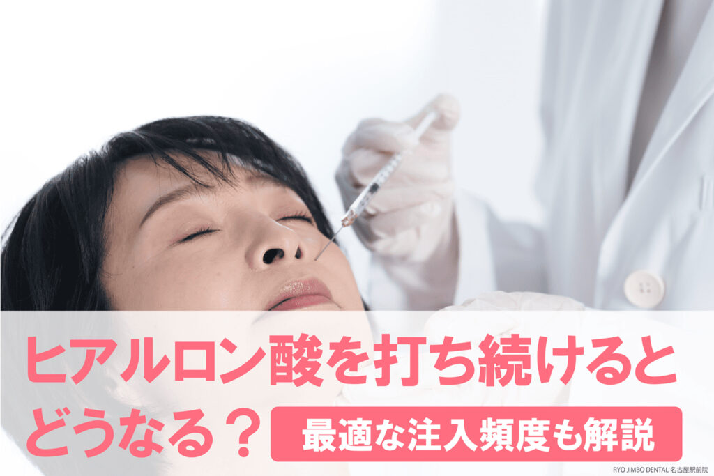 ヒアルロン酸を打ち続けるとどうなる？最適な注入頻度やデメリットなどをまとめて解説