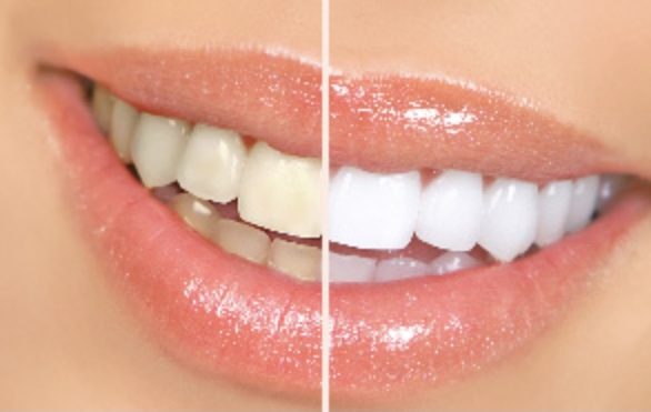 OPEN5年周年記念キャンペーン
