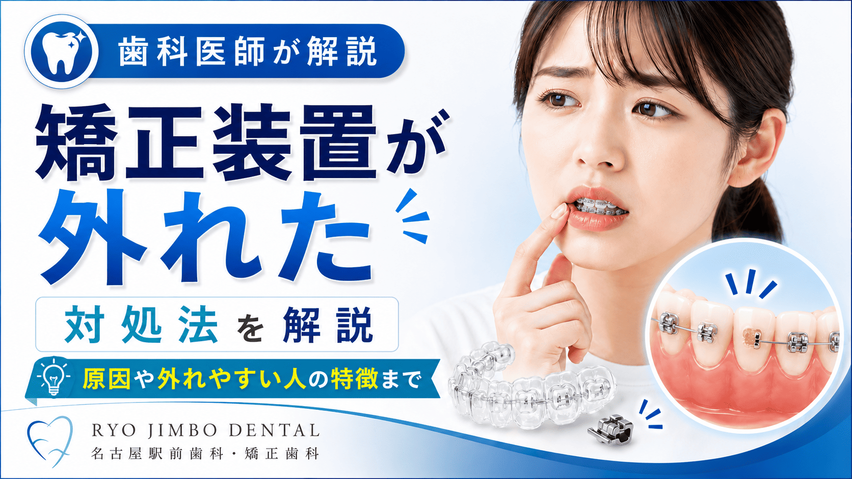 矯正治療中に装置が外れた場合の対処法｜原因や外れやすい人の特徴まで解説